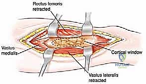 Clinical Image