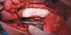 Clinical Image