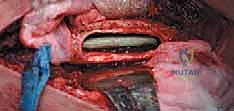 Clinical Image
