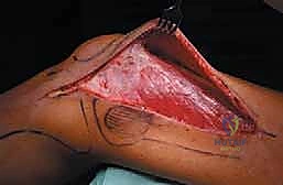 Clinical Image