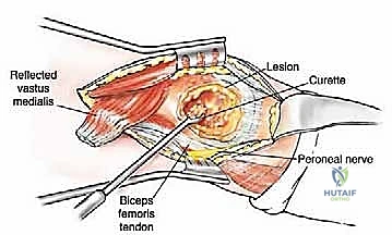Clinical Image