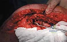 Clinical Image