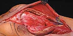 Clinical Image