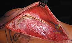 Clinical Image