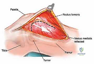 Clinical Image