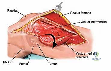 Clinical Image