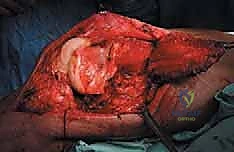 Clinical Image