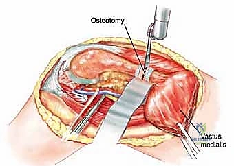 Clinical Image