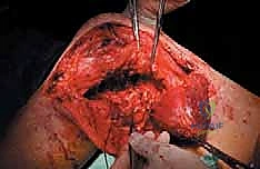 Clinical Image