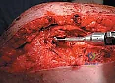 Clinical Image