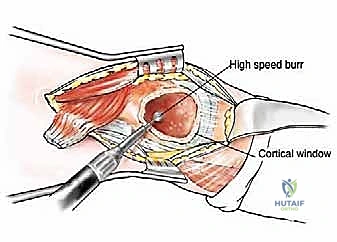 Clinical Image