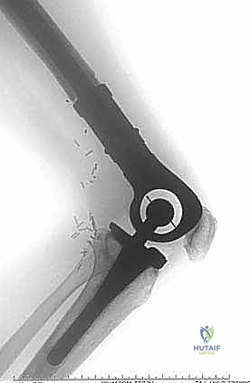 Clinical Image