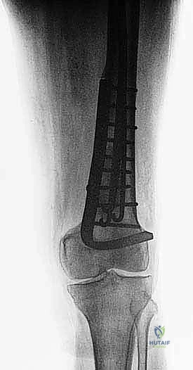 Clinical Image