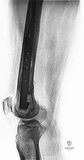 Clinical Image