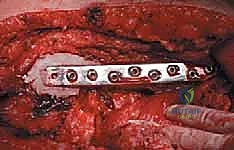 Clinical Image