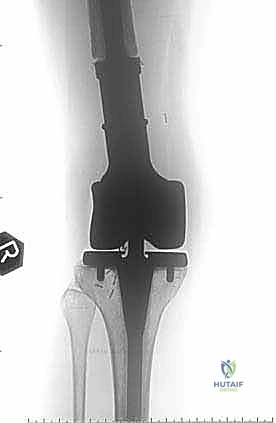 Clinical Image