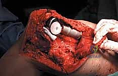 Clinical Image