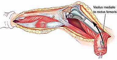 Clinical Image