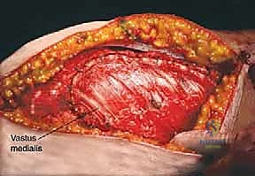 Clinical Image