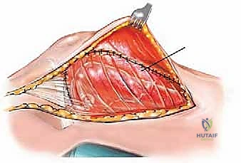 Clinical Image
