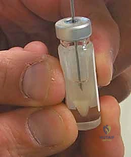 صورة طبية: زرع الخلايا الغضروفية الذاتية ACI: استعادة غضروف الركبة بدقة وفعالية مع الأستاذ الدكتور محمد هطيف