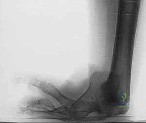 مقارنة شعاعية قبل التدخل الجراحي