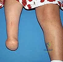 Clinical Image
