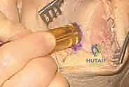 Master ABOS Orthopedic Board Review: Dysplasias, Osteomalacia, Infections, JIA | Part 7