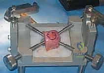 أسباب تلف الغضروف والآفات الغضروفية العظمية