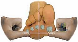 استخدام الأشعة السينية والتصوير المقطعي في تشخيص تشوهات القدم المعقدة