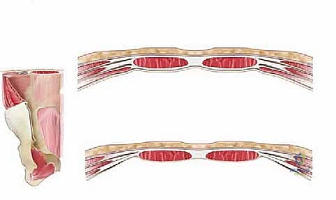 توضيح مسار النهج الأمامي للعمود الفقري