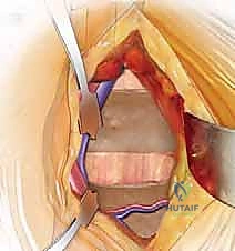 Clinical Image