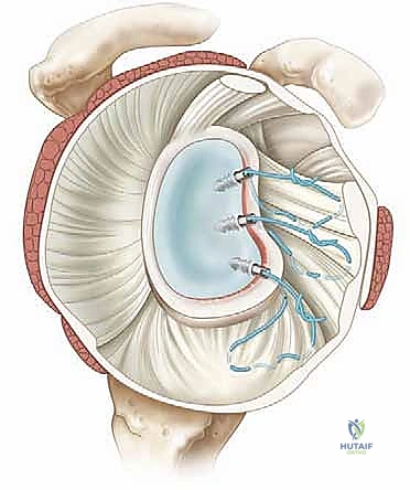 تشريح مفصل الكتف والأربطة المحيطة به