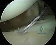 الفحص السريري الدقيق للكتف بواسطة الأستاذ الدكتور محمد هطيف