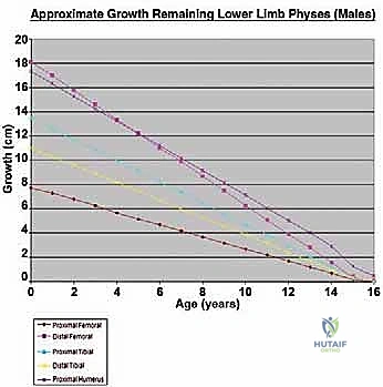 تقييم حالة ورم العظام في العيادة