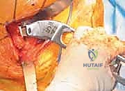 Clinical Image