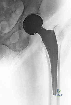 Clinical Image