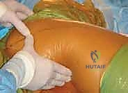 Clinical Image
