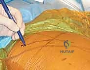 Clinical Image