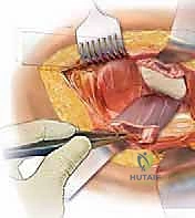 Clinical Image