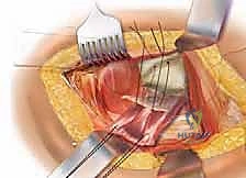 Clinical Image