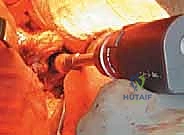 Clinical Image
