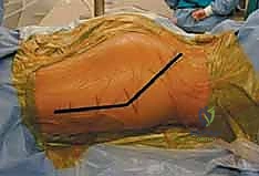 Clinical Image