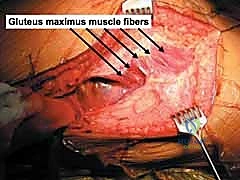 Clinical Image
