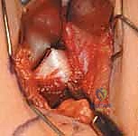 Clinical Image