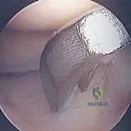 Clinical Image