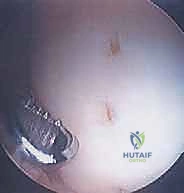 Clinical Image
