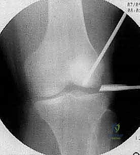 Clinical Image