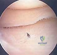 Clinical Image