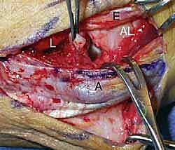 تأثير الإجهاد المزمن